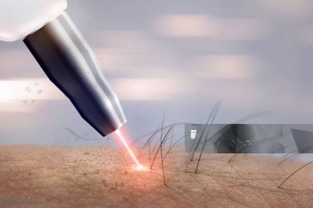 istockphoto-1059065742-612x612-transformed