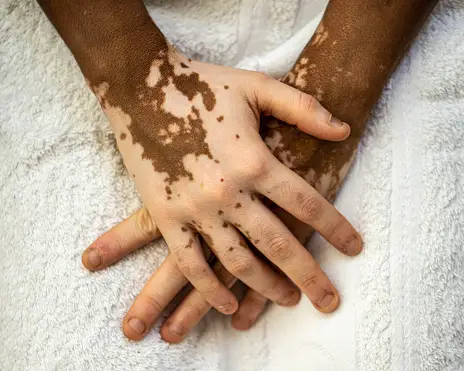 istockphoto-1403627696-170667a