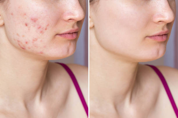 istockphoto-1508860310-612x612